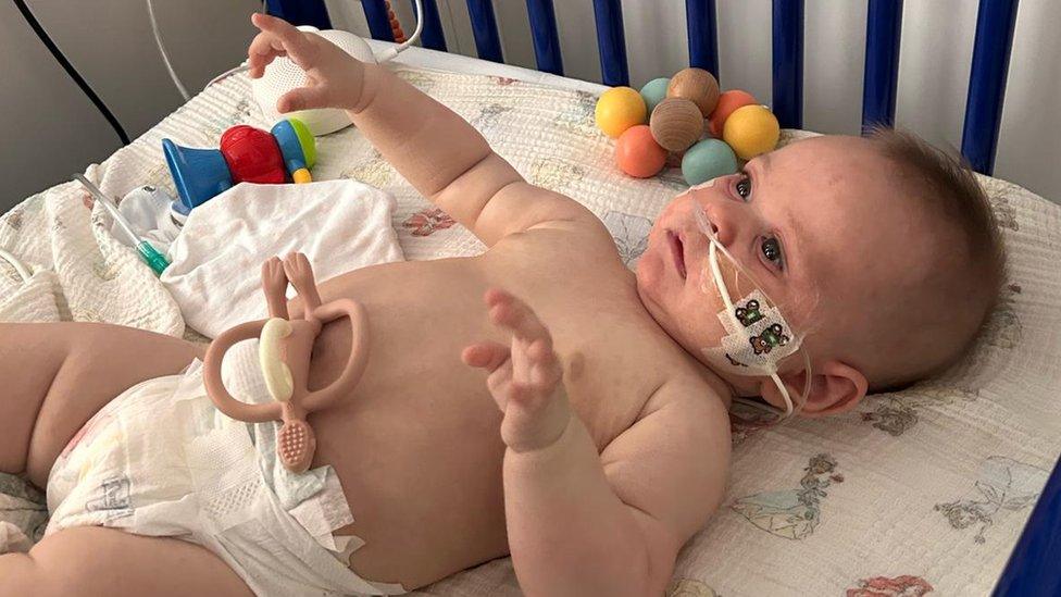 Image showing baby Margot lying on a bed with her breathing tube in