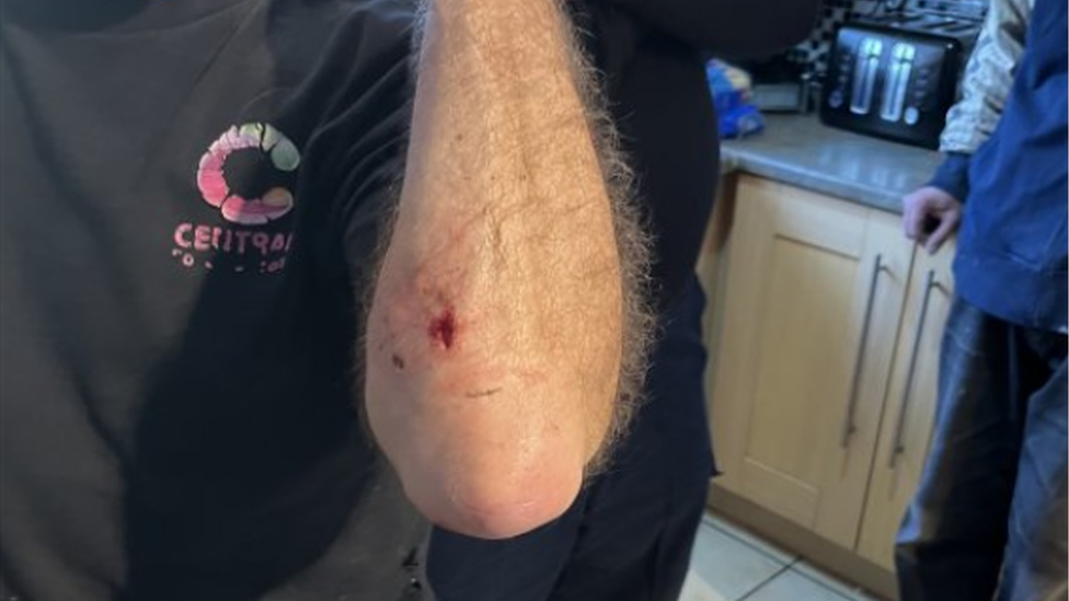 Simon Edge's elbow