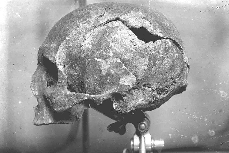 1925 photograph of skull found in a wooden box in Kirkwall's St Magnus Cathedral