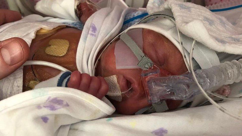 After Gabriel was born 15 weeks premature, his mum had to leave her job