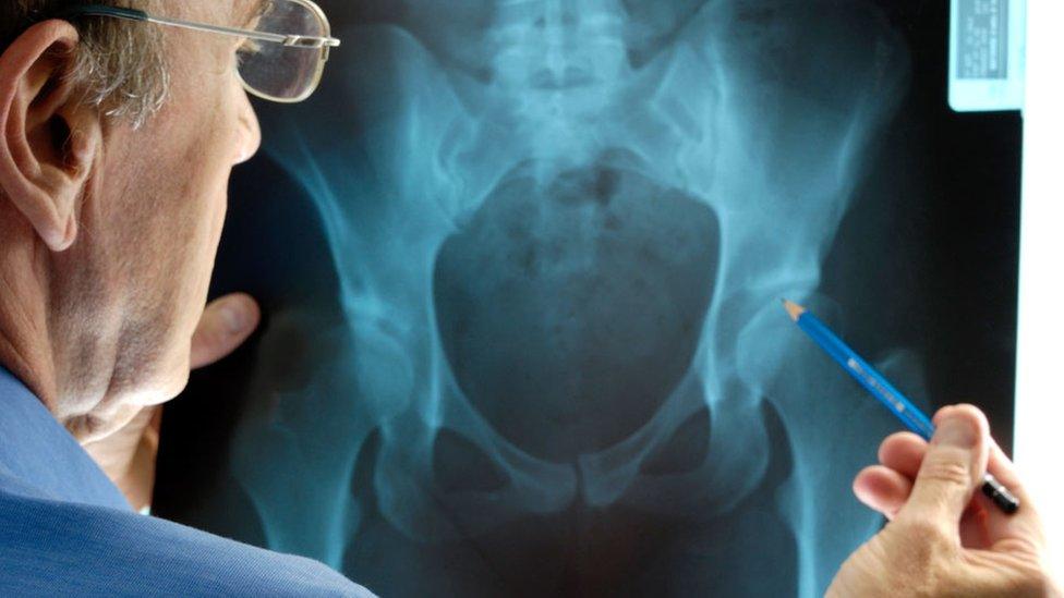 Doctor examining x-ray