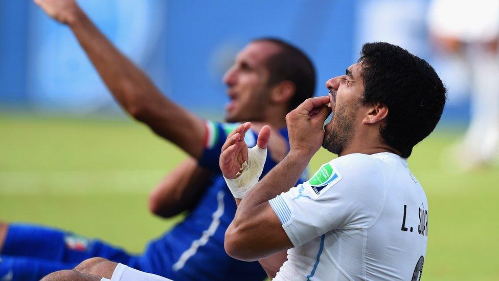 Luis-Suarez-holding-his-teeth.