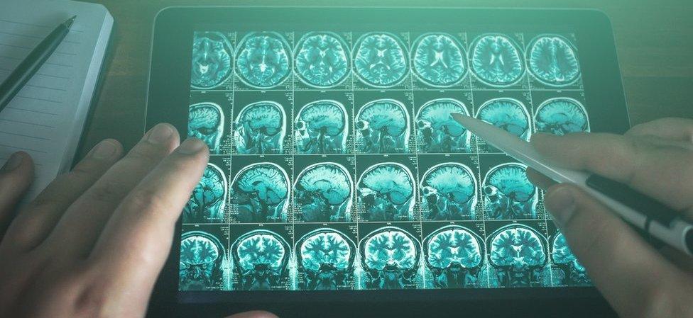 Brain scans displayed on a tablet