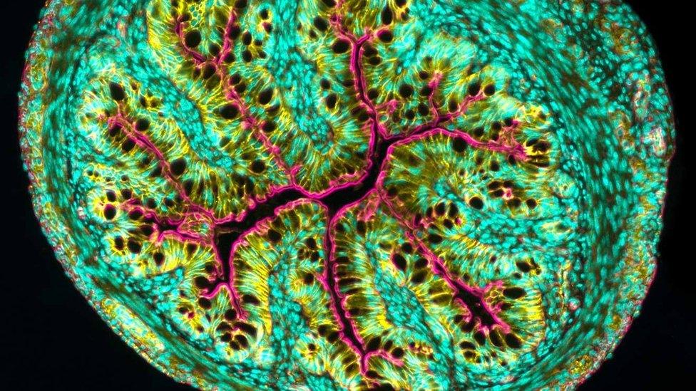 Cross section of a mouse intestine