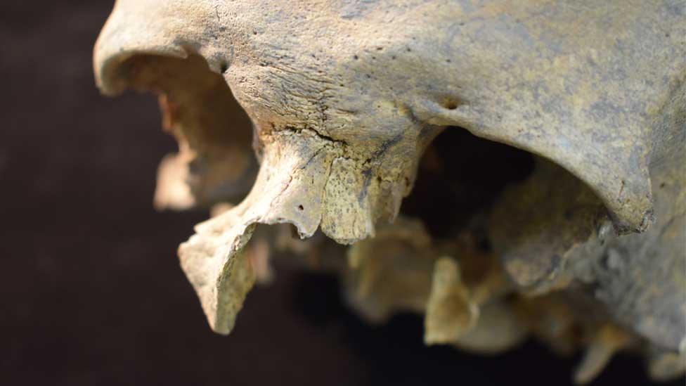 Skull from parish of All Saints' By the Castle, Cambridge