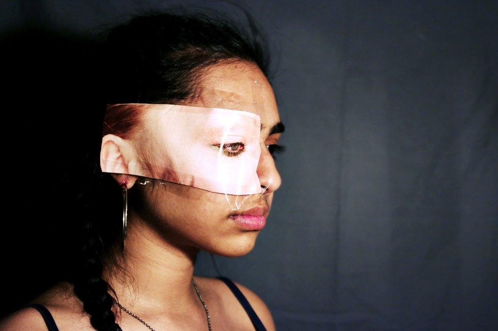 A girl has white skin taped over her eye