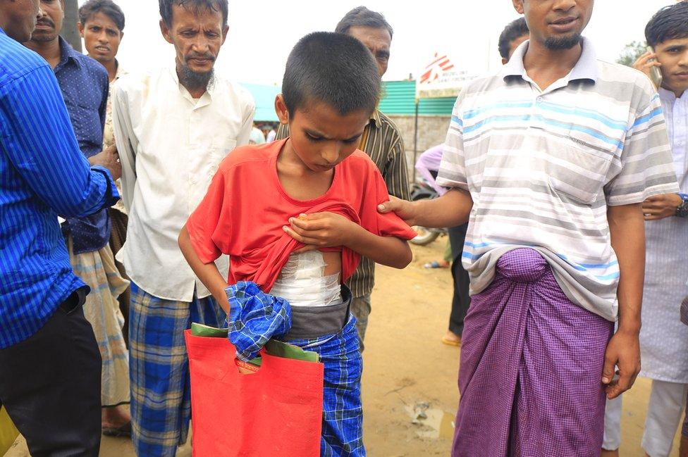 An injured Rohingya boy lifts his T-shirt to reveal a large bandage across his stomach