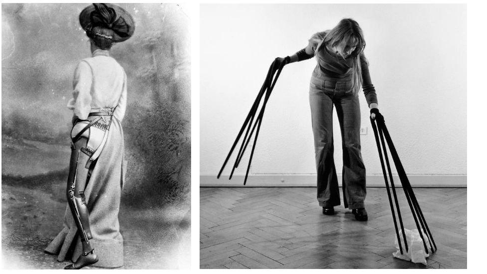 Woman wearing an artificial leg, 1890-1910 (left) and Rebecca Horn’s Finger Gloves (1972)