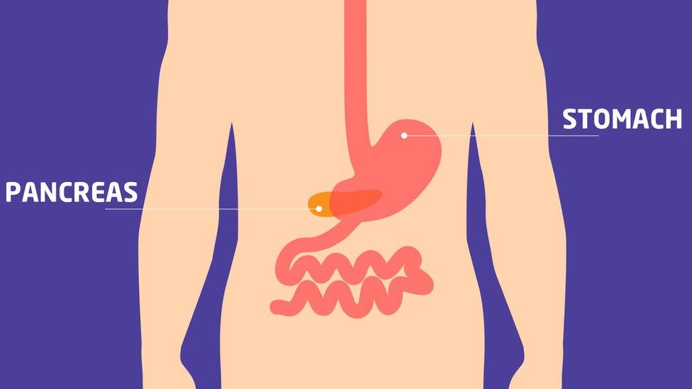 Graphic showing where the pancreas is