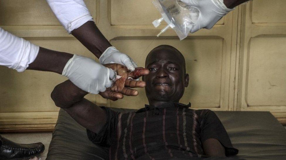 A wounded man is treated at the General Hospital in Bangui on September 26, 2015