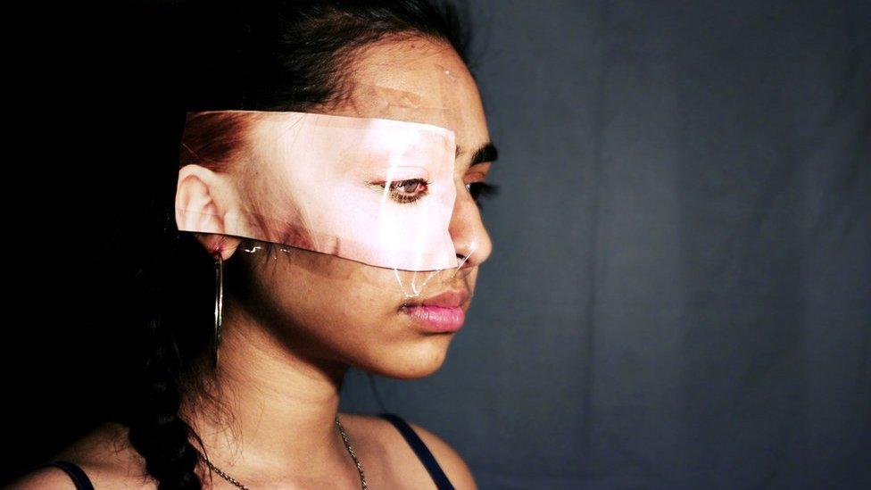 A girl has white skin taped over her eye