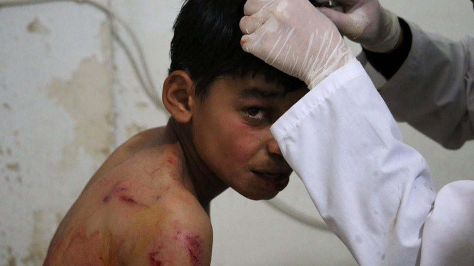 A Syrian boy receives medical treatment at a field hospital in the southern Syrian city of Daraya after he was hit in the head by shrapnel following a strike by a government forces' missile on the rebel-held part of the city on April 25, 2016.