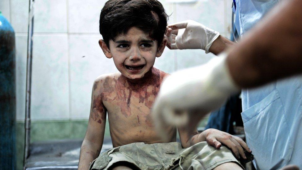 A Syrian boy receives treatment after he was wounded when shells, released by a regime force's helicopter, hit his house in Syria's northern city of Aleppo in August