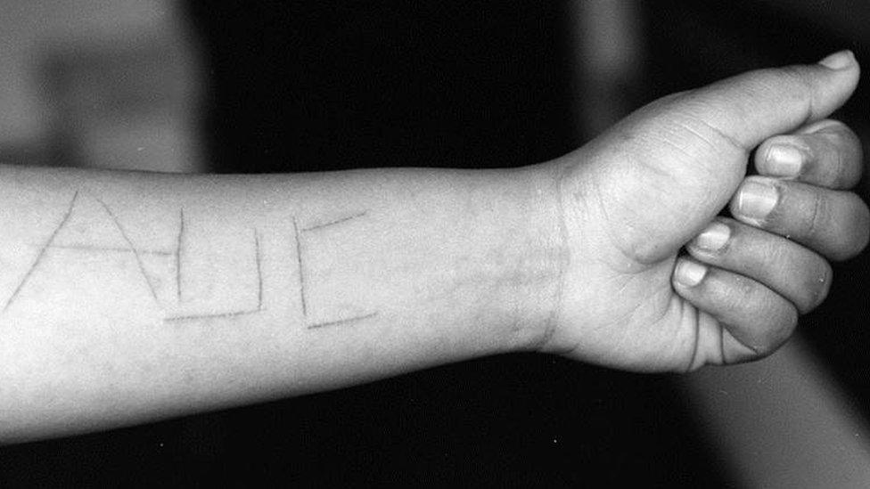 Initials of the United Self-defence Forces of Colombia, the Autodefensas Unidas de Colombia (AUC), cut with a knife into the arm of a young woman by paramilitaries who kidnapped and raped her in one of the poor neighbourhoods of Medellin in November 2002