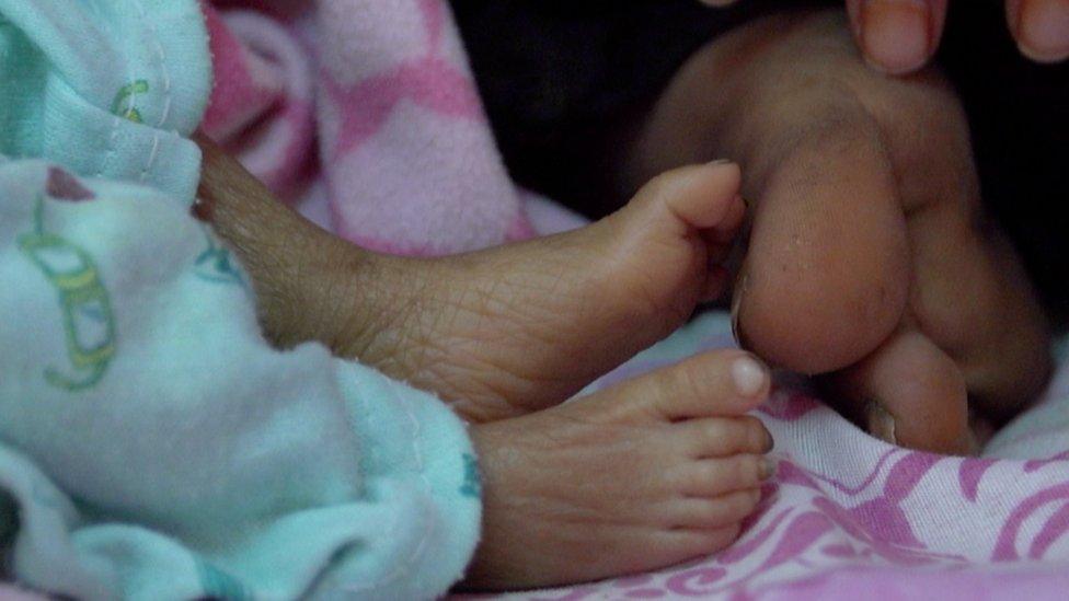 Child's feet in Yemen