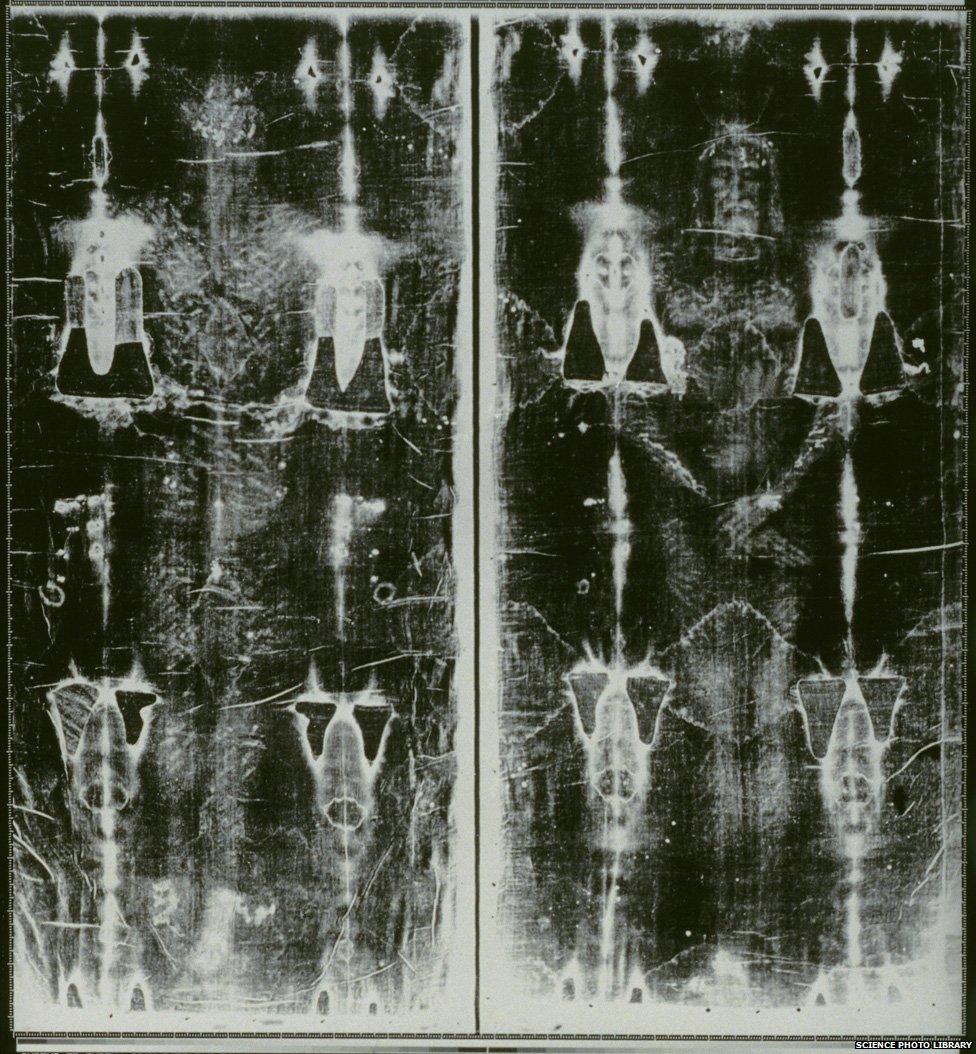 Shroud Of Turin Causes