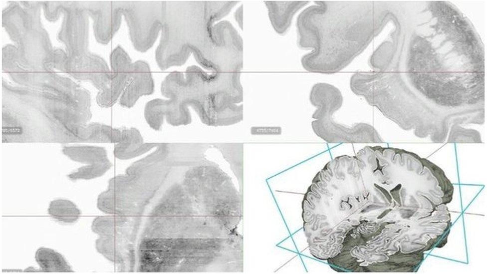 BigBrain 3D map