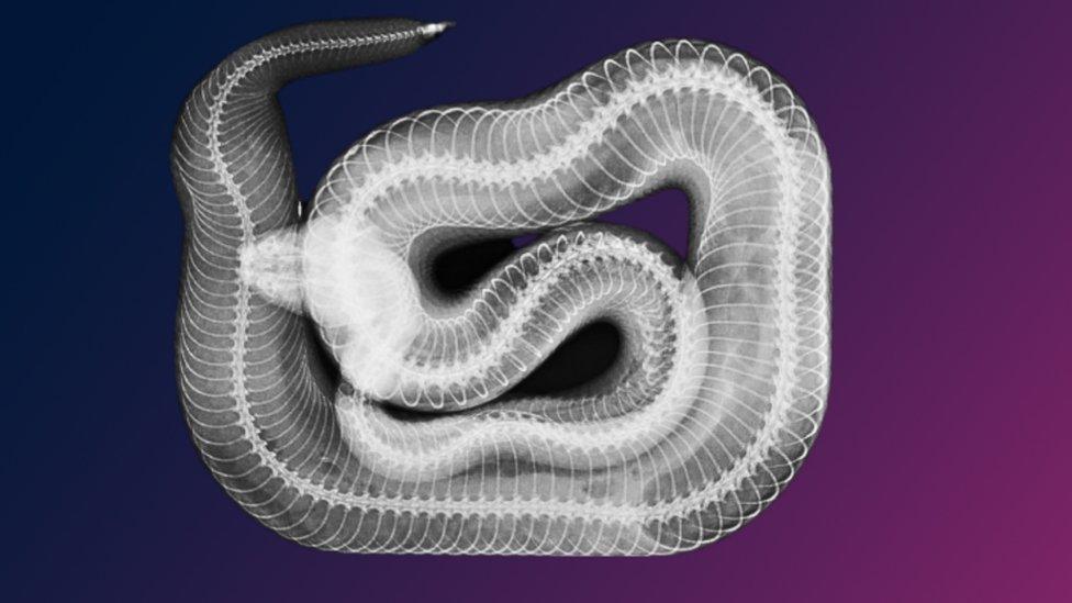 x-ray of a rattlesnake