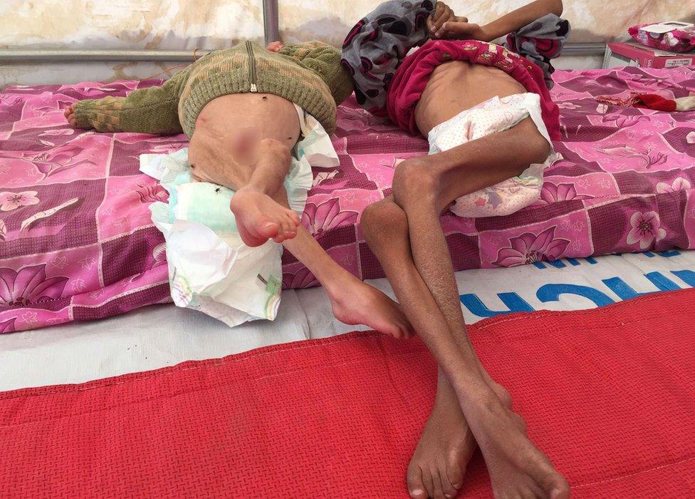 Image of skeletal children in the Hasansham refugee camp, Iraq