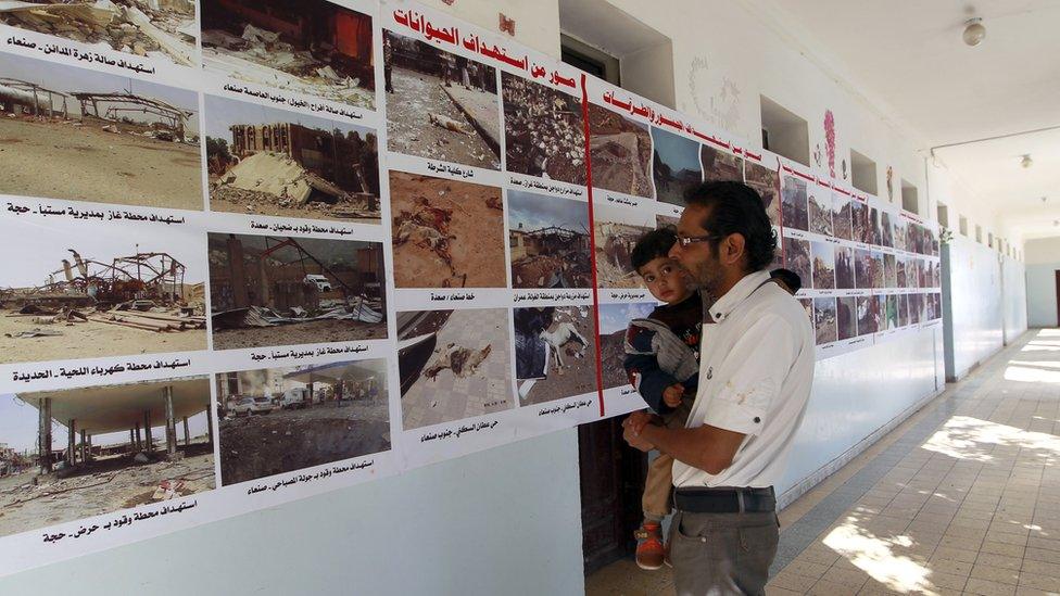 In the capital, Sanaa, the rebels have put up billboards showing health facilities allegedly destroyed by air strikes