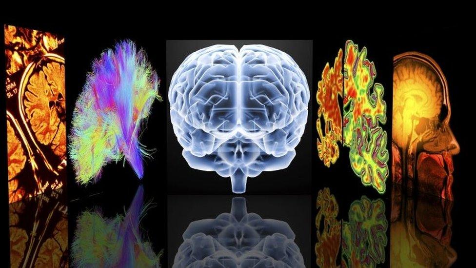 Conceptual computer artwork depicting neurology