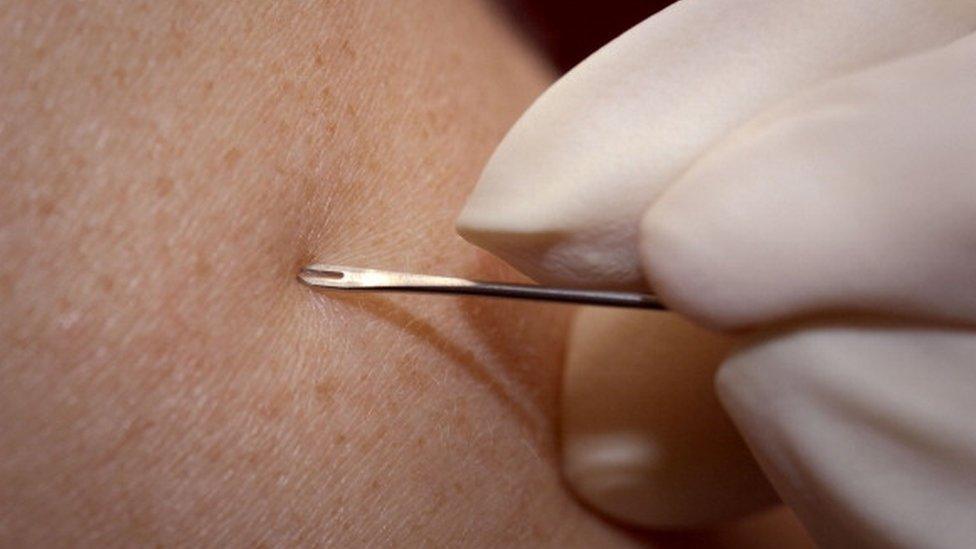 Clinician demonstrates the use of a bifurcated needle during the 2002 Vaccinator Workshop in Atlanta, GA