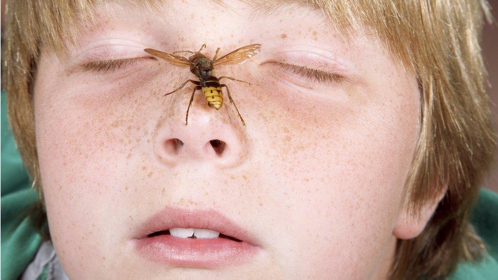 boy-with-wasp-on-his-nose.