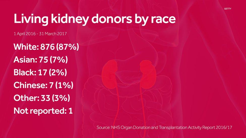 A fact box on the number of organ donors separated by race