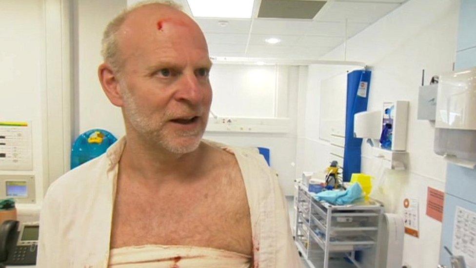 Actor Jon Jupp with fake injuries