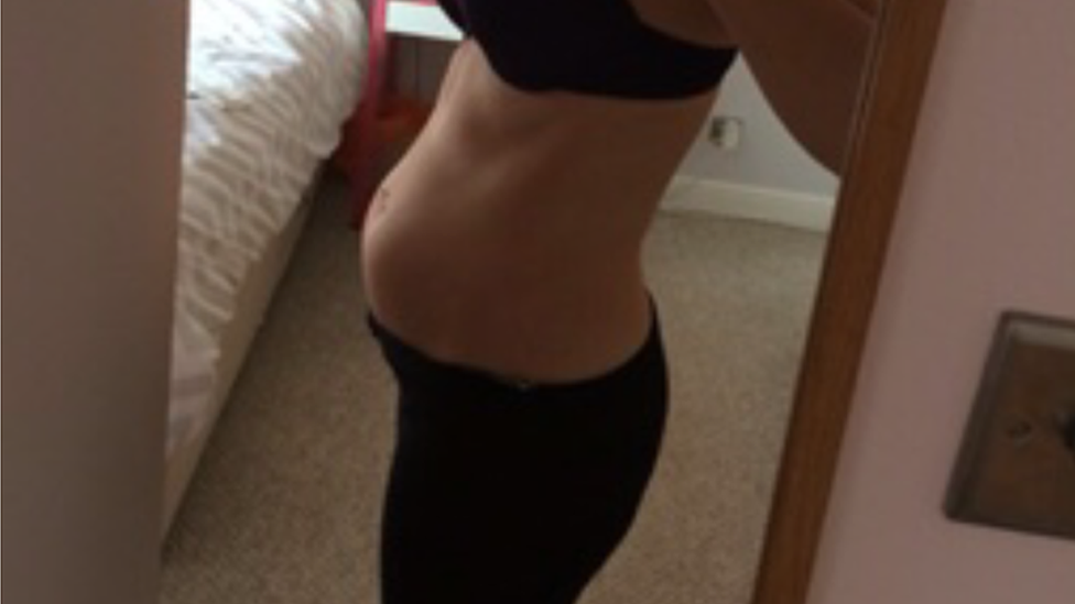 Laura Everley's bloated stomach