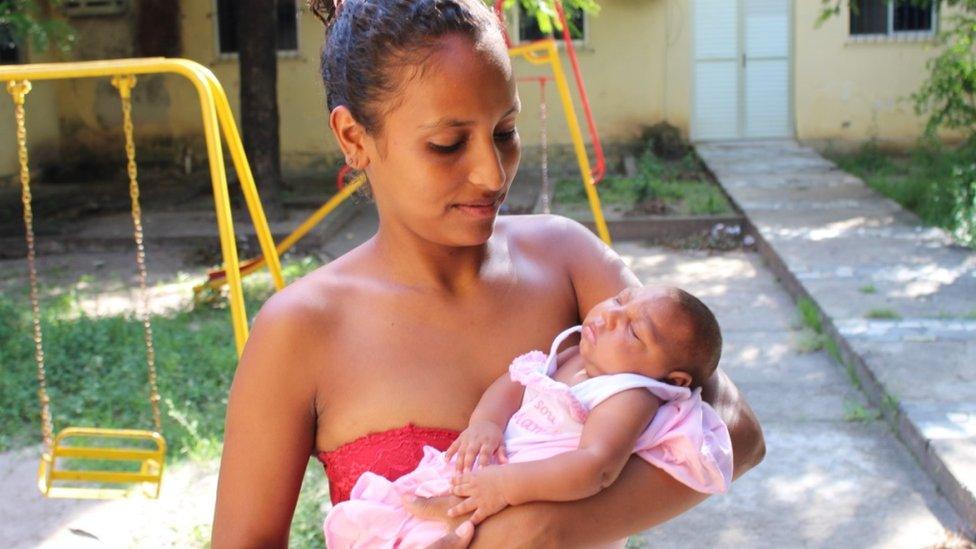 Baby in mother's arms with microcephaly