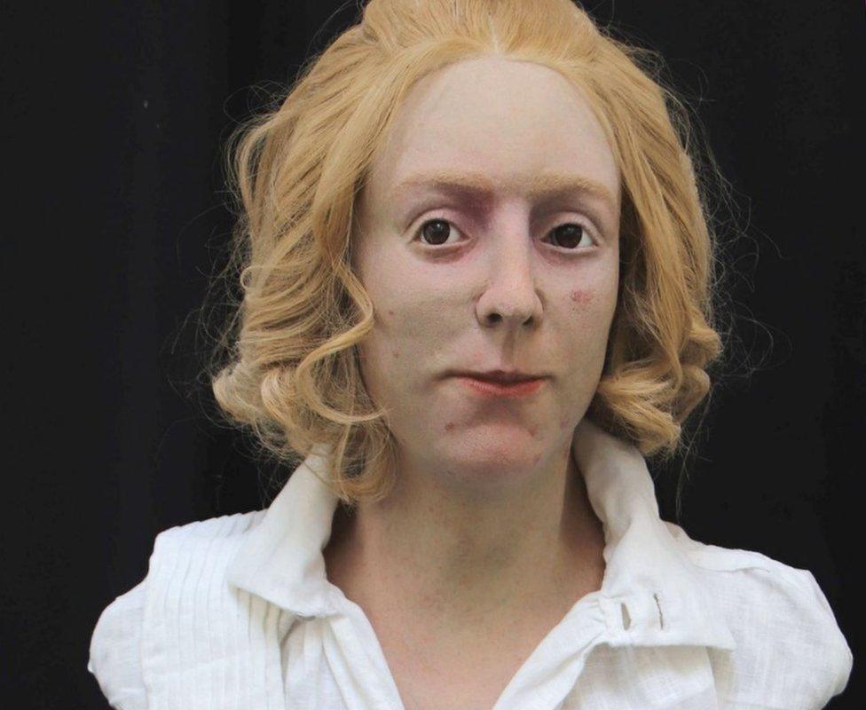 Bonnie Prince Charlie facial reconstruction