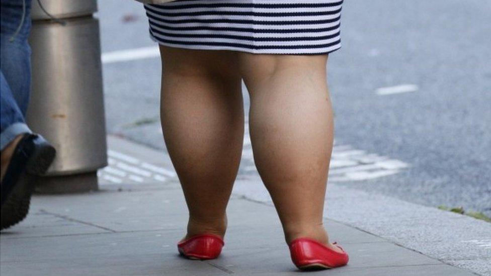 overweight legs