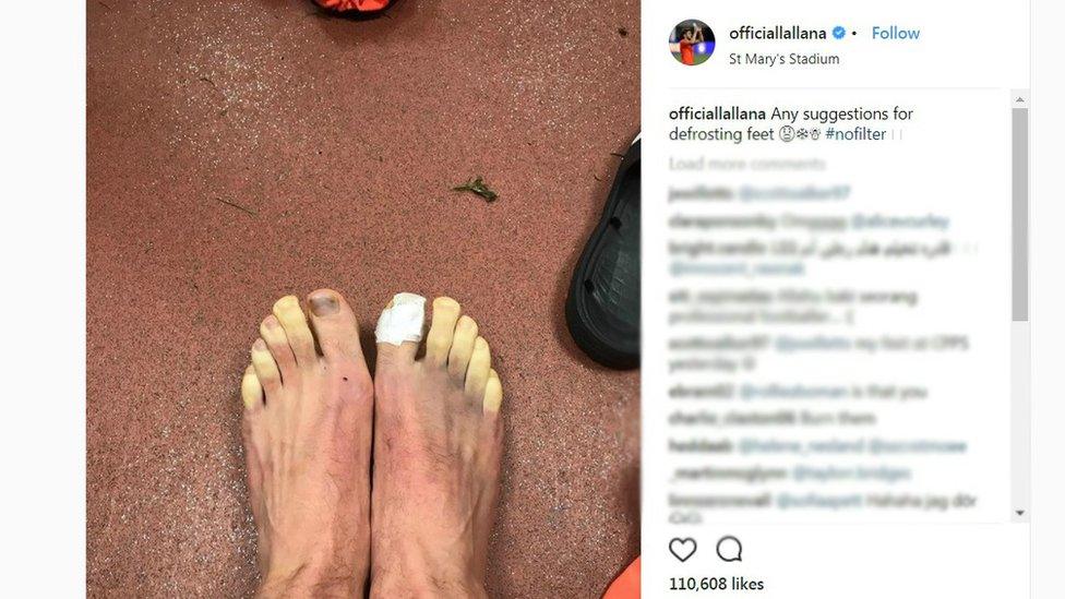 frozen toes