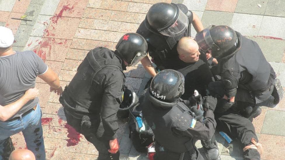 Riot police and injured man in Kiev (31 August 2015)