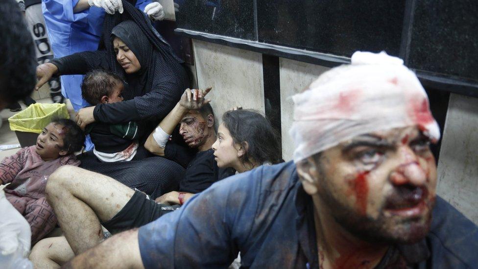 Casualties are treated while sitting on the floor at Al-Aqsa Martyrs Hospital in Deir al-Balah, in central Gaza (11 December 2023)