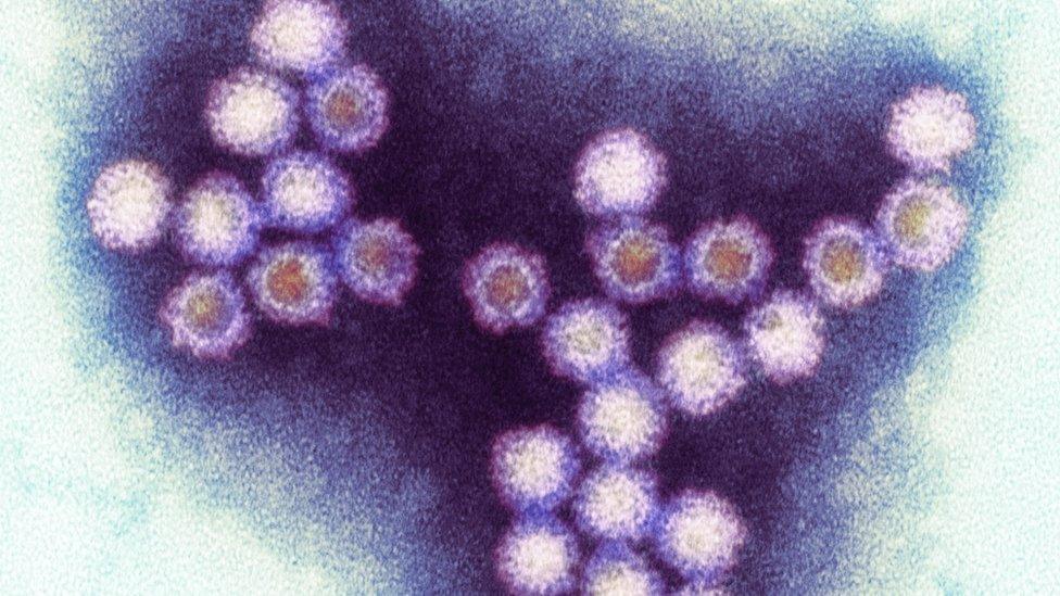 Norovirus