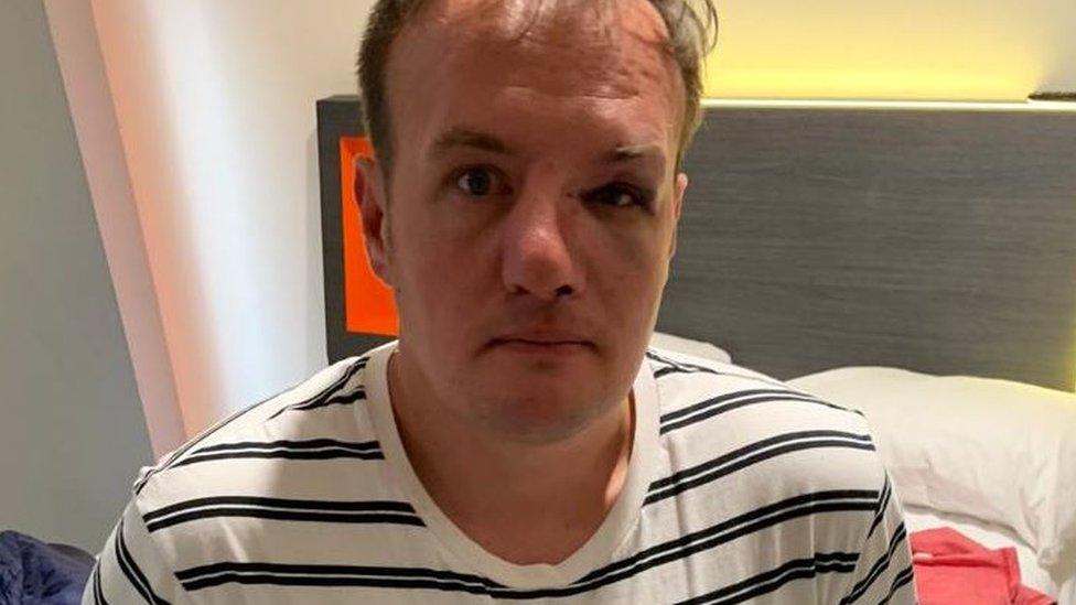 Michael suffered a vicious homophobic attack in Birmingham