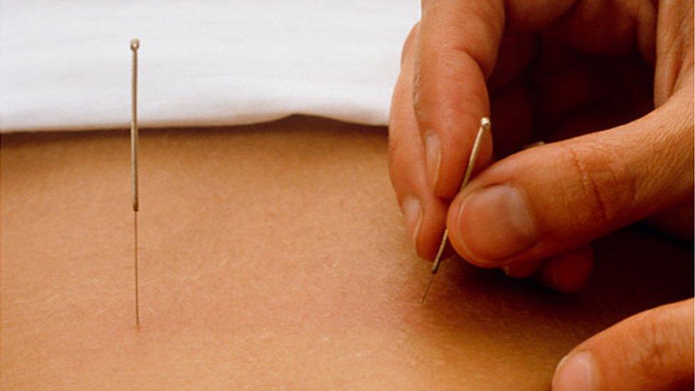 Acupuncture is normally given to adults
