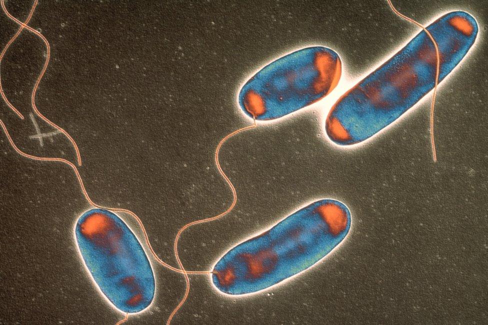 Legionella bacteria. Coloured transmission electron micrograph (TEM) of a section through Legionella pneumophila bacteria, the cause of Legionnaires' disease.