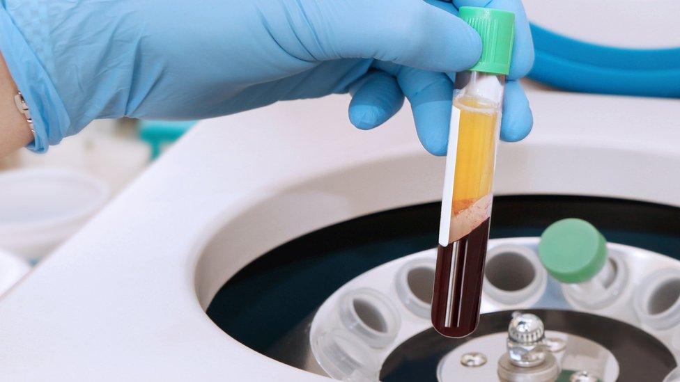 A vial of blood in a centrifuge