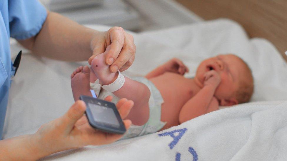 Baby having a heel prick test