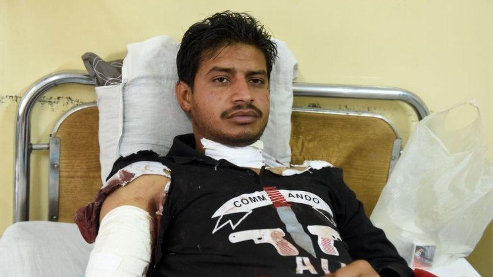 An injured Pakistani policeman rests on a hospital bed in Quetta on October 25, 2016, after an overnight militant attack on the Police Training College Balochistan