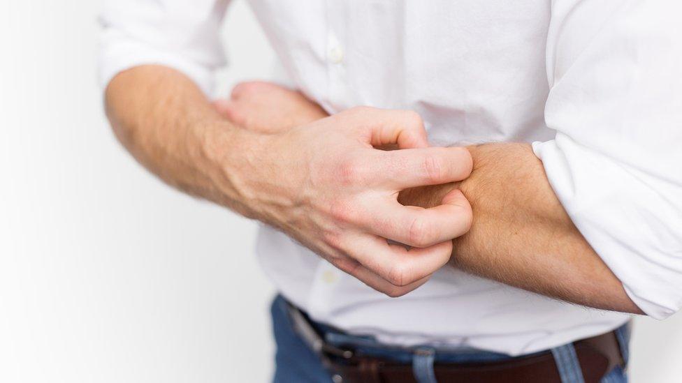 Man scratching his forearm