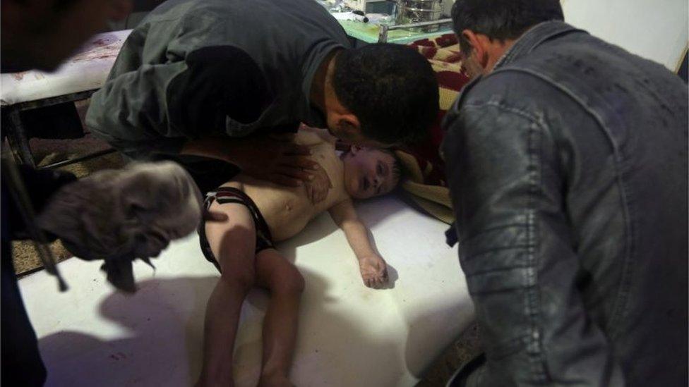 Child treated in Douma after suspected chemical attack (07/04/18)