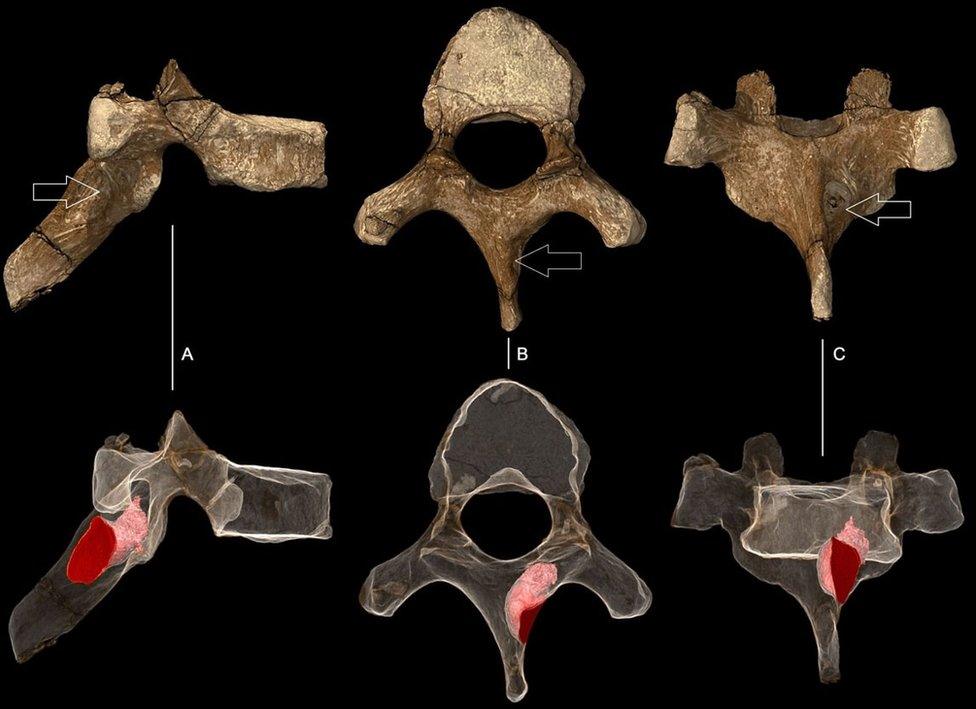 Spine scans