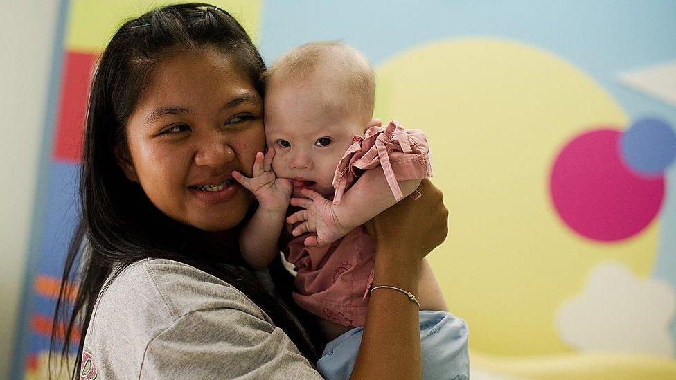 Baby Gammy with his surrogate mother Pattaramon Chanbua, who has raised him