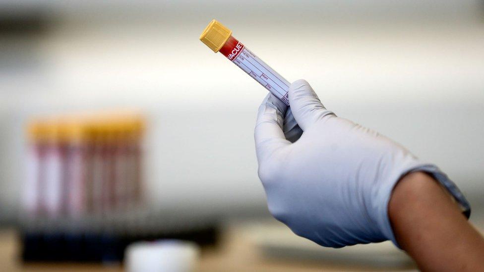 Close up of gloved hand holding a blood sample