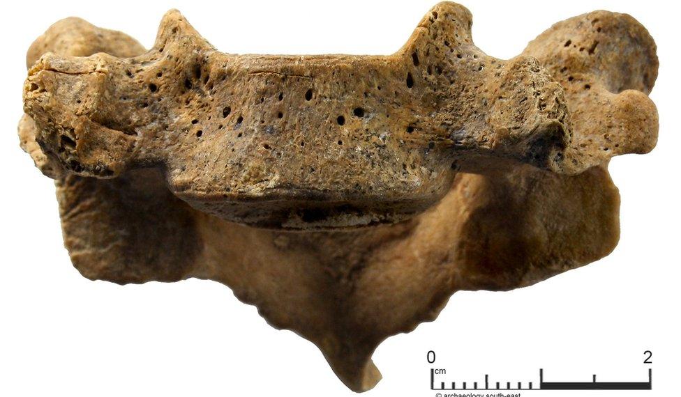 Vertebra from the skeleton