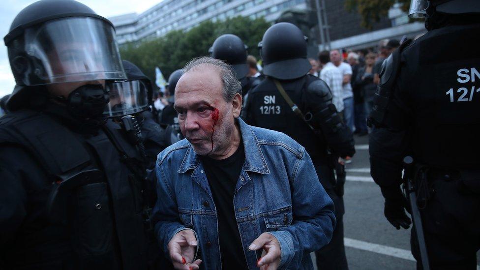 A bleeding protester is escorted by police in Chemnitz, 27 August